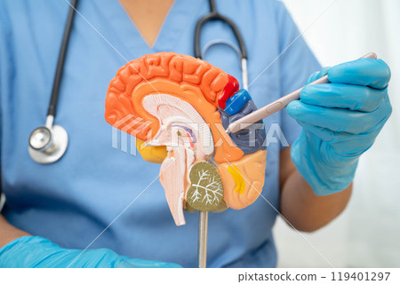Alzheimer disease, Asian doctor holding brain anatomy model for study diagnosis and treatment in hospital. 119401297
