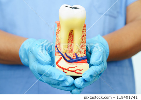 Dentist holding dental implant, artificial tooth roots into jaw, root canal of dental treatment, gum disease, teeth model for dentist. Dentist holding dental implant, artificial tooth roots into jaw, root canal of dental treatment, gum disease, teeth model for dentist. 119401741