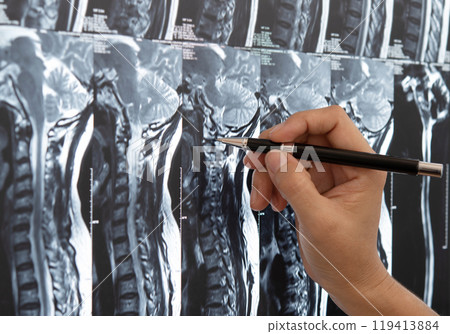 doctor spine x-ray film 119413884