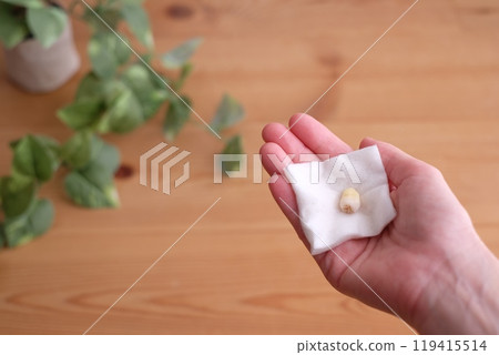 Wisdom tooth extraction Wisdom tooth extraction 119415514