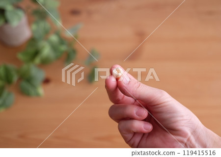 拔智齒 拔智齒 119415516