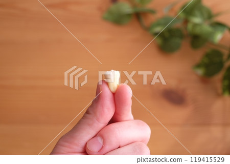 Wisdom tooth extraction 119415529