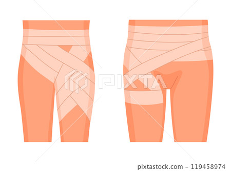 Human hip bandaging. Medical bandage, injured body part, emergency treatment for dislocation, sprains and tendon damage flat vector illustration set. Physical injury bandages 119458974
