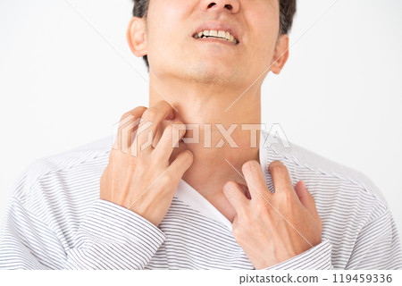 Middle-aged man suffering from dry skin 119459336