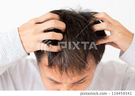 A middle-aged man suffering from dry scalp A middle-aged man suffering from dry scalp 119459341