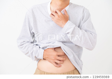 中年男子皮膚乾燥 119459369