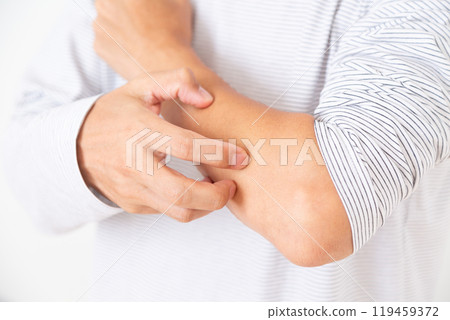Middle-aged man suffering from dry skin 119459372