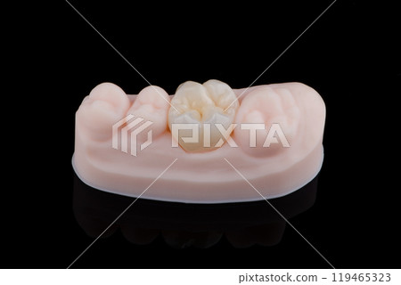 High-quality single dental crown with naturally morphology made of multilayer zirconia for upper jaw High-quality single dental crown with naturally morphology made of multilayer zirconia for upper jaw 119465323