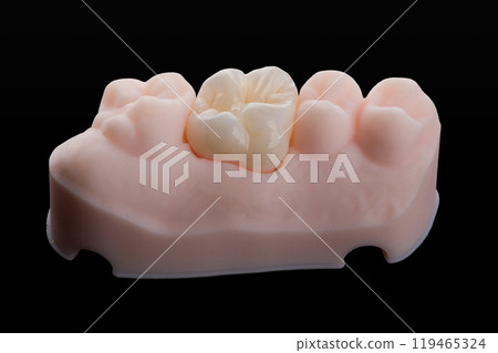 High-quality single dental crown with naturally morphology made of multilayer zirconia for upper jaw High-quality single dental crown with naturally morphology made of multilayer zirconia for upper jaw 119465324