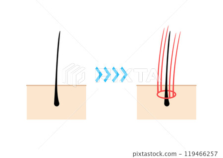 Illustration of hair extensions being applied 119466257