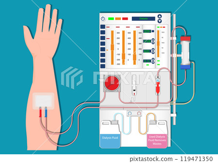 Hemodialysis or hemo is one type of dialysis treatment. 119471350