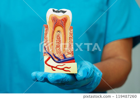 Dentist holding dental implant, artificial tooth roots into jaw, root canal of dental treatment, gum disease, teeth model for dentist. 119487260