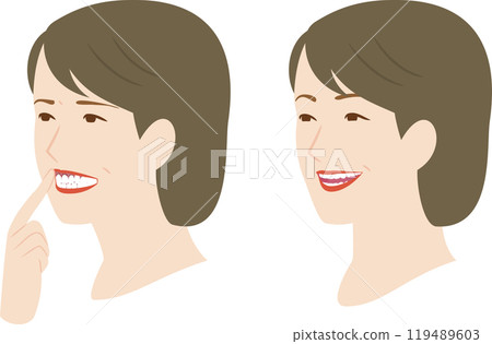 牙齒健康、牙齦因膿漏和牙周病而腫脹的微笑婦女 牙齒健康、牙齦因膿漏和牙周病而腫脹的微笑婦女 119489603