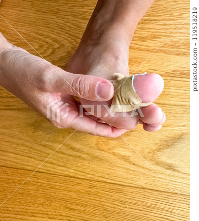 The injured toe is wrapped with a Band-Aid. High quality photo 119518219
