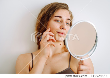 Cute woman with rashes on her face looks into a small mirror. Natural beauty. Cosmetology, care. Cute woman with rashes on her face looks into a small mirror. Natural beauty. Cosmetology, care. 119524335
