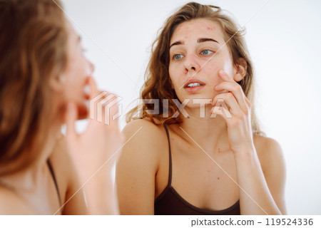 Young woman looks in mirror examining inflammation on her face. Acne skin. Medicine and cosmetology. Young woman looks in mirror examining inflammation on her face. Acne skin. Medicine and cosmetology. 119524336