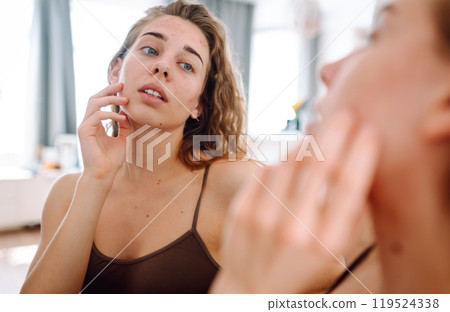 Young woman looks in mirror examining inflammation on her face. Acne skin. Medicine and cosmetology. Young woman looks in mirror examining inflammation on her face. Acne skin. Medicine and cosmetology. 119524338