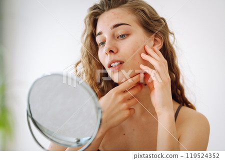 Cute woman with rashes on her face looks into a small mirror. Natural beauty. Cosmetology, care. 119524352