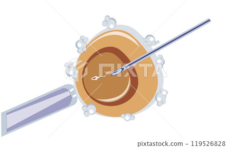 Artificial insemination of oocyte, intracytoplasmic injection, IVF Artificial insemination of oocyte, intracytoplasmic injection, IVF 119526828