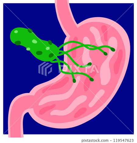 Helicobacter pylori vector illustration. Cartoon stomach, bacteria 119547623