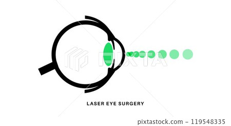 Lasik eye surgery Lasik eye surgery 119548335
