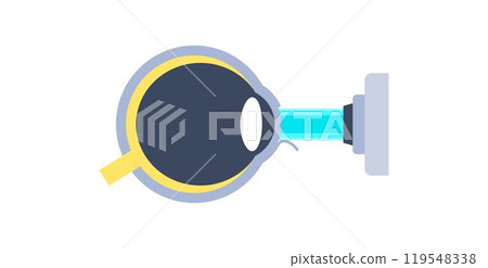 Lasik eye surgery Lasik eye surgery 119548338