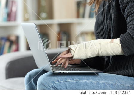 Disabled woman with bandaged arm using laptop 119552335
