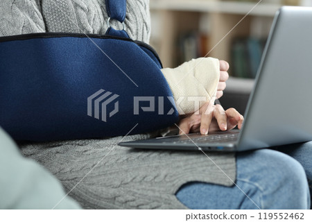 Woman with broken arm wearing sling using laptop Woman with broken arm wearing sling using laptop 119552462