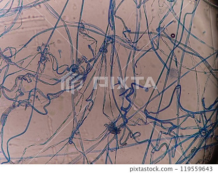 順利傳播蜘蛛真菌菌絲 119559643