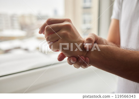 The man's hand, he uses steroids Apply External type. The man's hand, he uses steroids Apply External type. 119566343