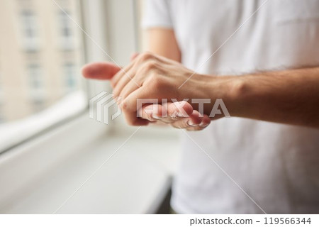 The man's hand, he uses steroids Apply External type. 119566344