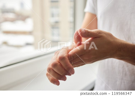 The man's hand, he uses steroids Apply External type. The man's hand, he uses steroids Apply External type. 119566347