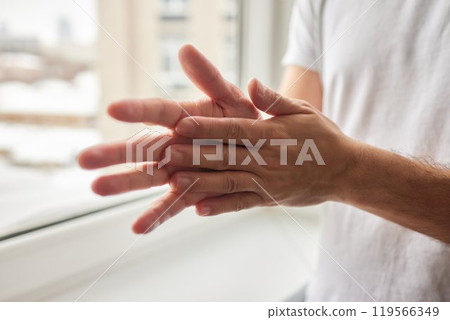 The man's hand, he uses steroids Apply External type. 119566349