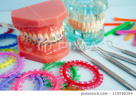 Orthodontic ligatures rings and ties, elastic rubber bands on orthodontic braces, model for dentist studying about dentistry. Orthodontic ligatures rings and ties, elastic rubber bands on orthodontic braces, model for dentist studying about dentistry. 119590264