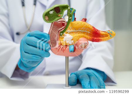 Pancreatitis, pancreatic cancer, Asian doctor with pancreas, gallbladder and bile duct human anatomy model at hospital. 119590299