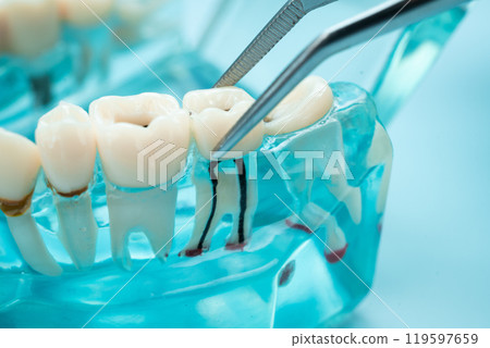 Dental teeth model with dentist tool for dentistry. 119597659