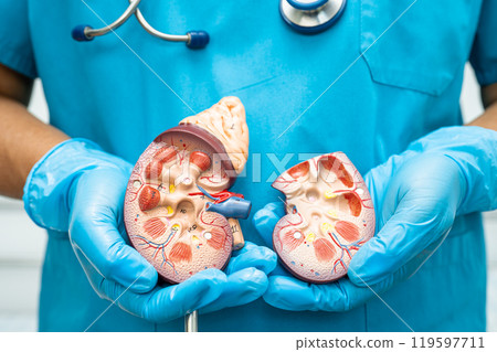 Kidney disease, Chronic kidney disease ckd, Doctor hold human model to treat and study in hospital. 119597711