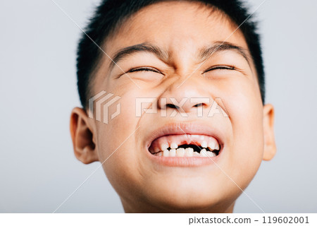 Child smile reveals lost upper tooth gap. Dental growth isolated on white. Joyful tooth fairy moment. Children show teeth new gap, dentist problems. little boy no tooth 119602001