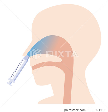 鼻疫苗接種圖解 鼻疫苗接種圖解 119604415
