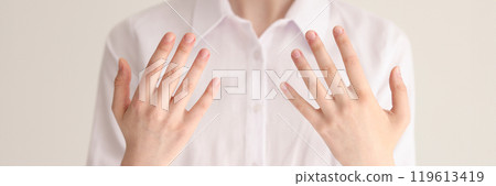 Young woman in white blouse shows hands to dermatologist 119613419
