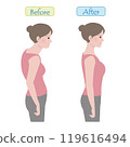 Before and after pictures of a woman with bad posture (slouching) and a woman with good posture Before and after pictures of a woman with bad posture (slouching) and a woman with good posture 119616494