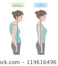 Before and after pictures of a woman with bad posture (hunchback) and correct posture (center of gravity line included) Before and after pictures of a woman with bad posture (hunchback) and correct posture (center of gravity line included) 119616496