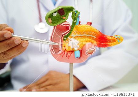 Pancreatitis, pancreatic cancer, Asian doctor with pancreas, gallbladder and bile duct human anatomy model at hospital. Pancreatitis, pancreatic cancer, Asian doctor with pancreas, gallbladder and bile duct human anatomy model at hospital. 119635371