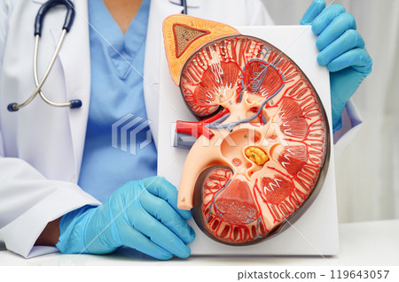 Chronic kidney disease, doctor with model for treatment urinary system, urology, Estimated glomerular filtration rate eGFR. 119643057