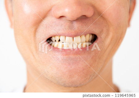 Middle-aged man's teeth 119645965