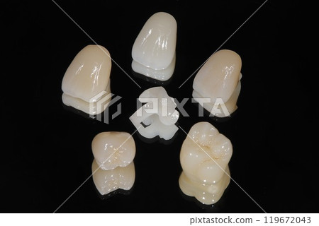 您想擁有美麗的瓷牙嗎？ 119672043