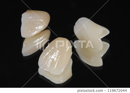 您想擁有美麗的瓷牙嗎? 您想擁有美麗的瓷牙嗎? 119672044