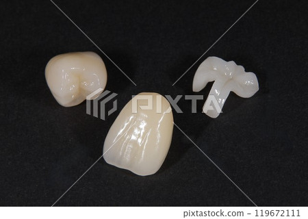 您想擁有美麗的瓷牙嗎? 您想擁有美麗的瓷牙嗎? 119672111