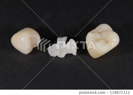 您想擁有美麗的瓷牙嗎? 您想擁有美麗的瓷牙嗎? 119672112