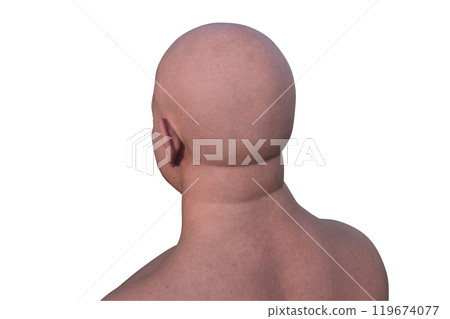 A man's hairless head from side back view, 3D illustration 119674077
